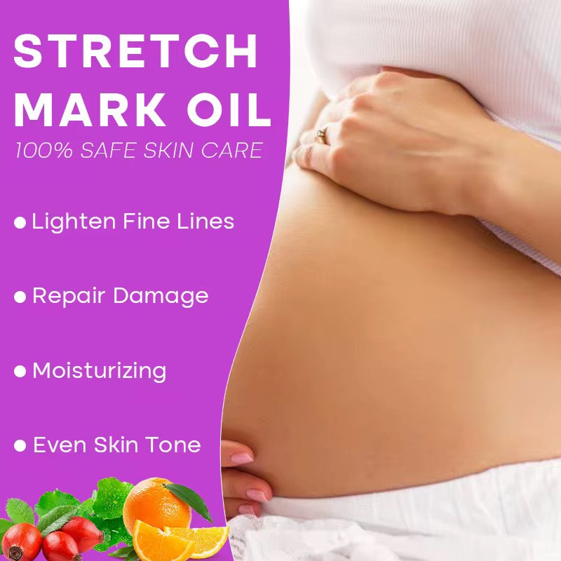 Organics Natural stretch mark oil. Lanorient Organic Stretch Mark Oil – Rosehip & Vitamin C + E (200ml)