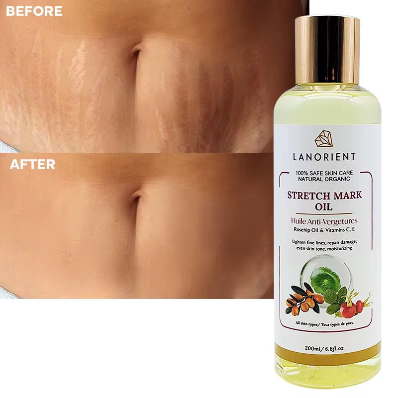 Organics Natural stretch mark oil. Lanorient Organic Stretch Mark Oil – Rosehip & Vitamin C + E (200ml)